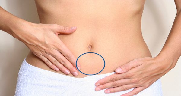 KL Natural Detox (The Original)