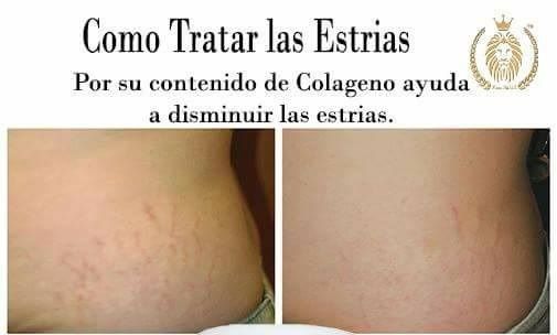Karinalily Slimming Gel with Collagen (Gel Reductor) (Tummy Gel) Pomada