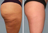 Radiant Glow Hydrolyzed Collagen with Vitamin C (Pills or Powder)